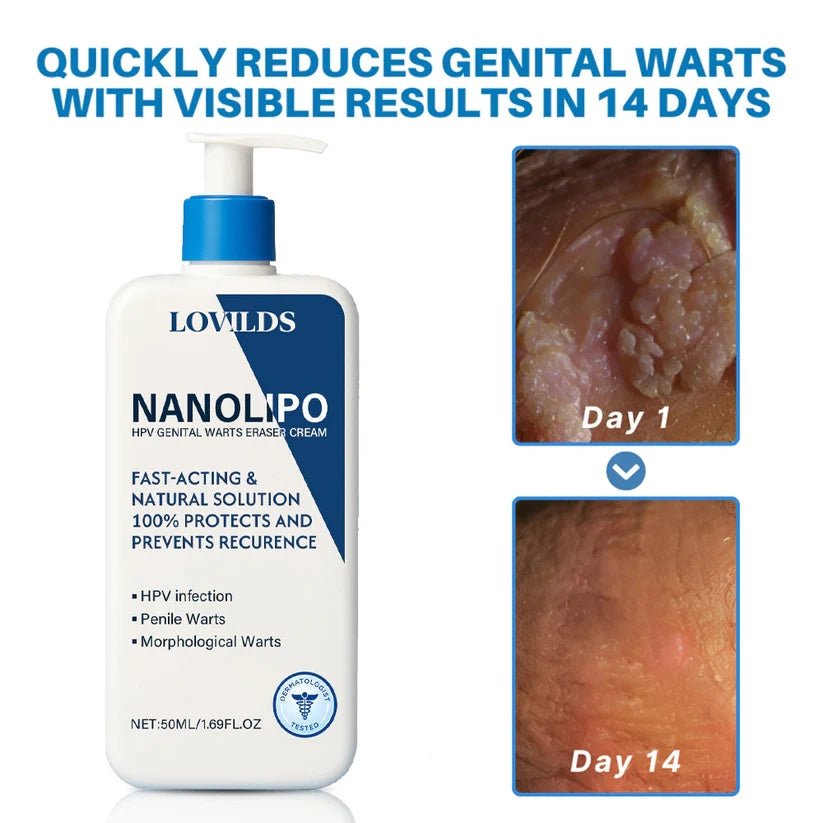 LOVILDS NanoLipo HPV Genital Warts Eraser Cream