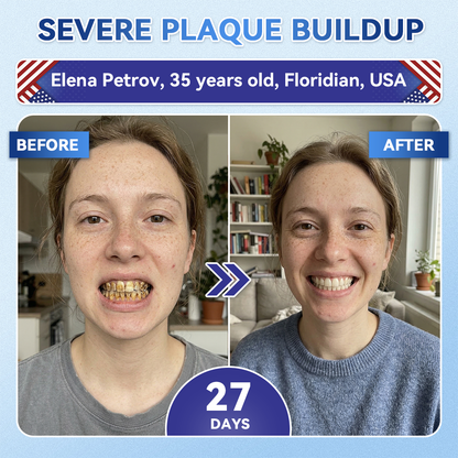 Alisanda® 🦷 Tideglusib Fast‑Dissolving Tooth & Gum Repair Oral Strips ✨