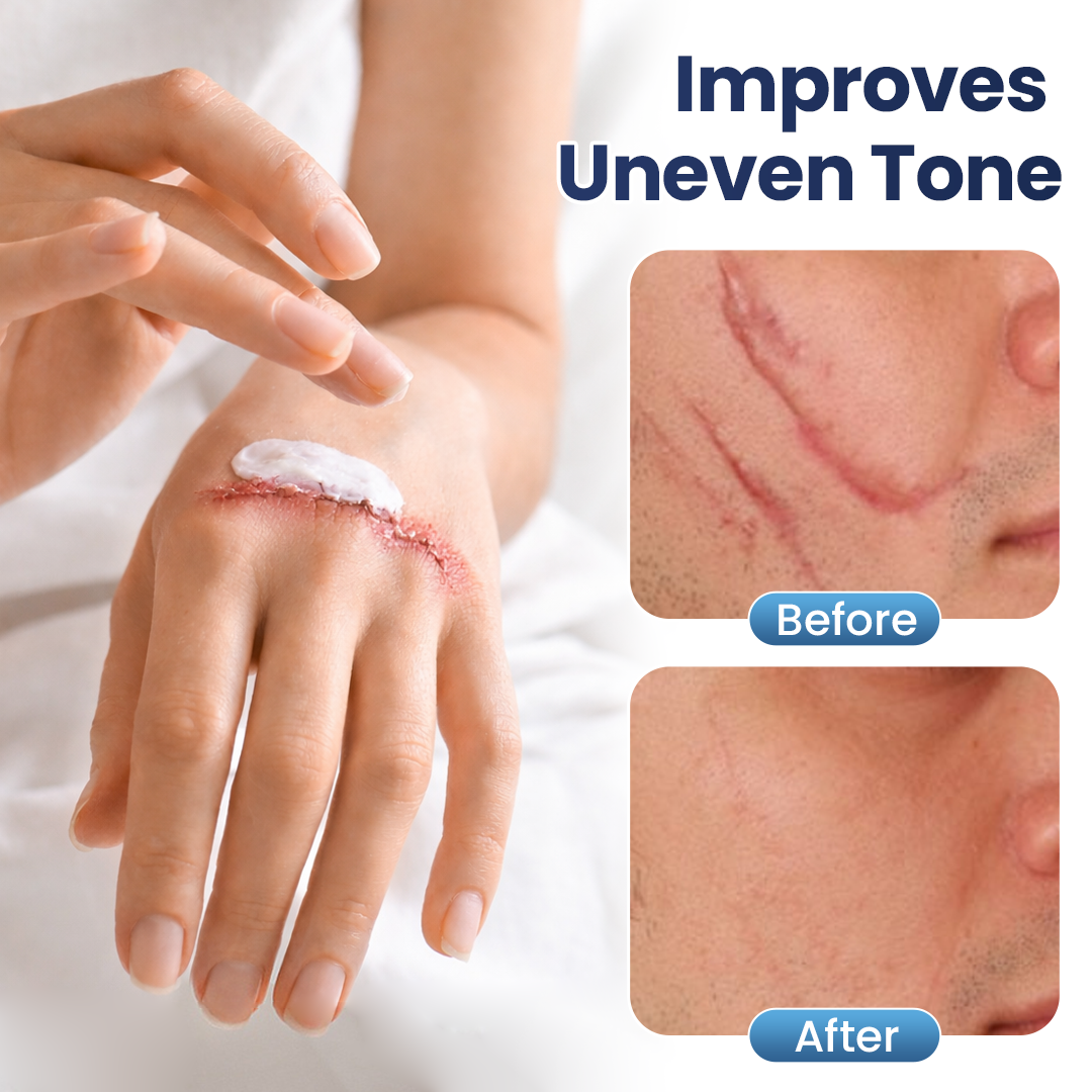 🔥Last Day Discount🔥 Alisanda® Texture Repair Gel