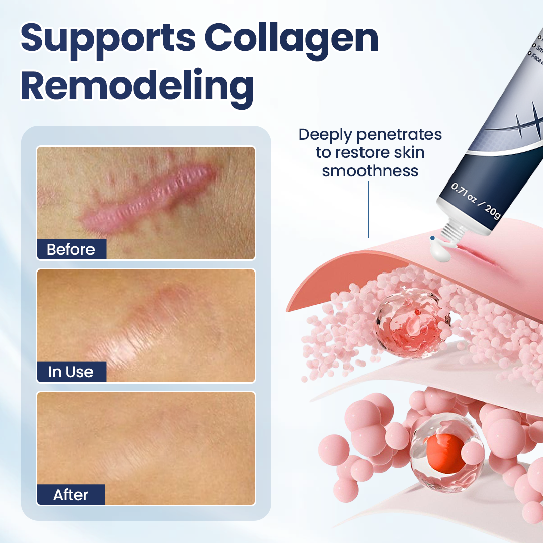 🔥Last Day Discount🔥 Alisanda® Texture Repair Gel