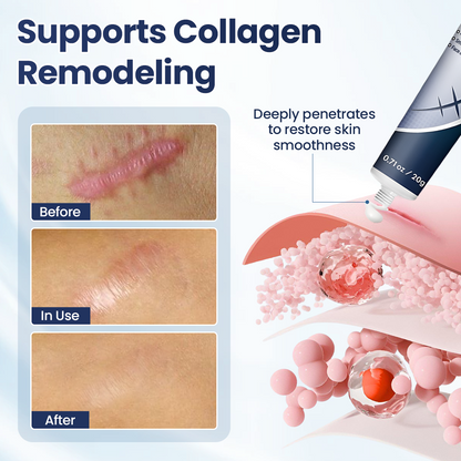 🔥Last Day Discount🔥 Alisanda® Texture Repair Gel