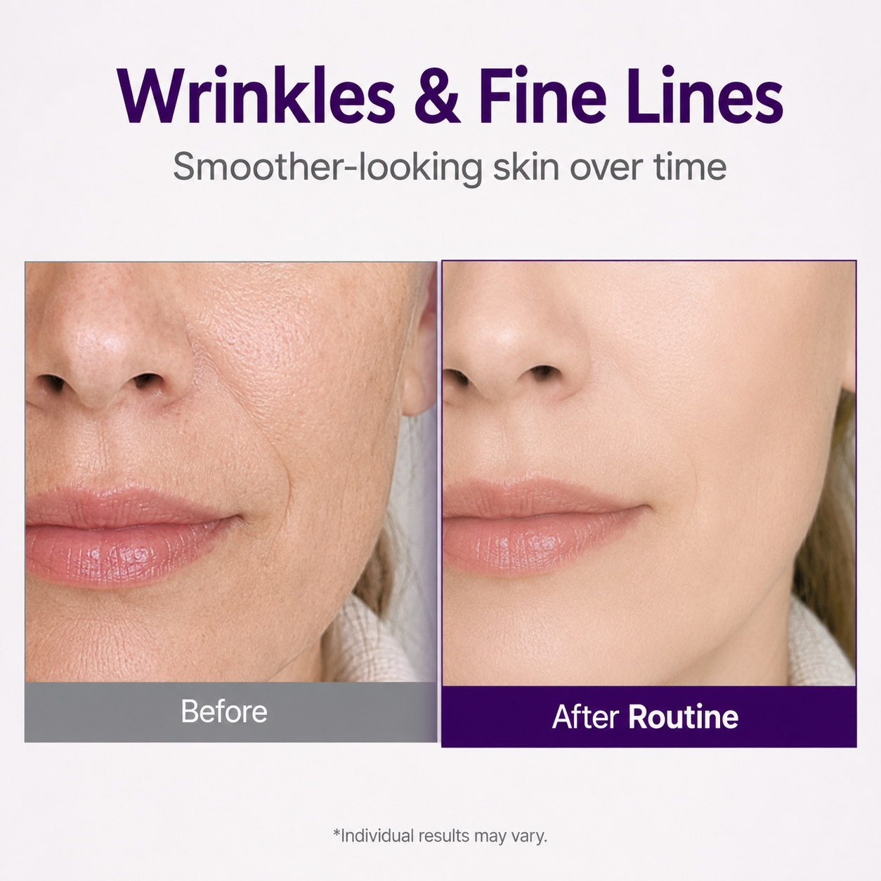 💜 NESLEMY Retinol + Retinal NAD+ Firming Serum – Smoother, Firmer & Younger-Looking Skin ✨