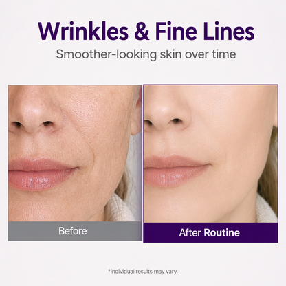💜 NESLEMY Retinol + Retinal NAD+ Firming Serum – Smoother, Firmer & Younger-Looking Skin ✨