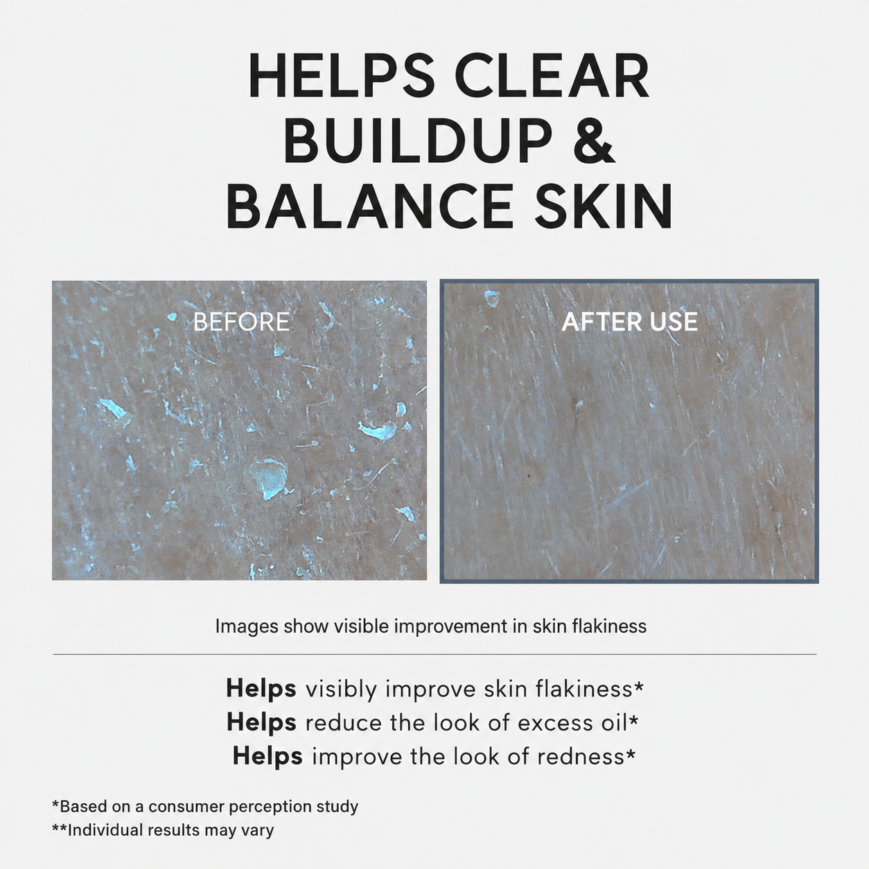 ✨ NESLEMY AHA + BHA Glycolic Acid Exfoliating Serum – Pore Care & Texture Refining ✨