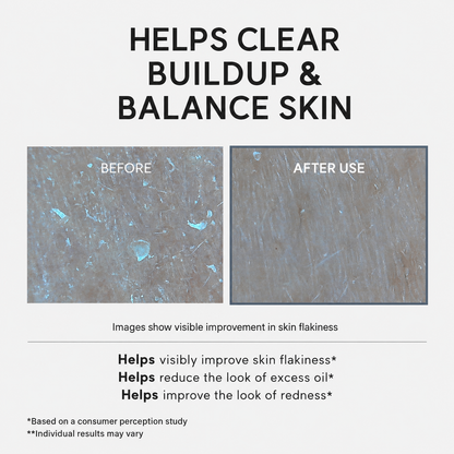 ✨ NESLEMY AHA + BHA Glycolic Acid Exfoliating Serum – Pore Care & Texture Refining ✨