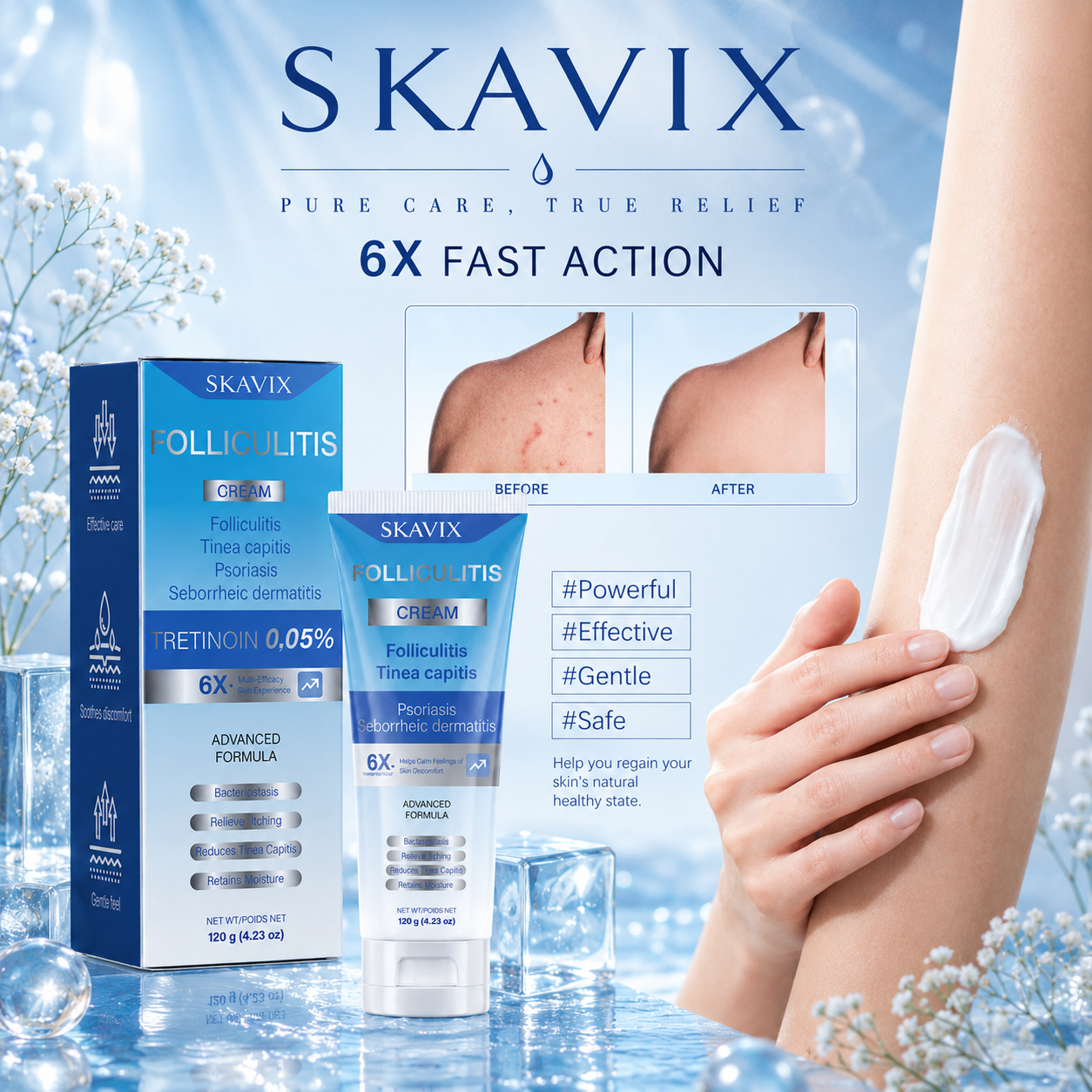 💙 SKAVIX Folliculitis Soothing Cream for Folliculitis Scalp Face and Body 💙