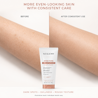 ✨ NESLEMY Even Tone Dark Spot Body Cream ✨