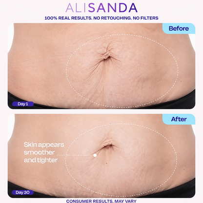 💜 ALISANDA Tighten & Smooth Belly Cream – Firming, Stretch Mark & Loose Skin Care ✨